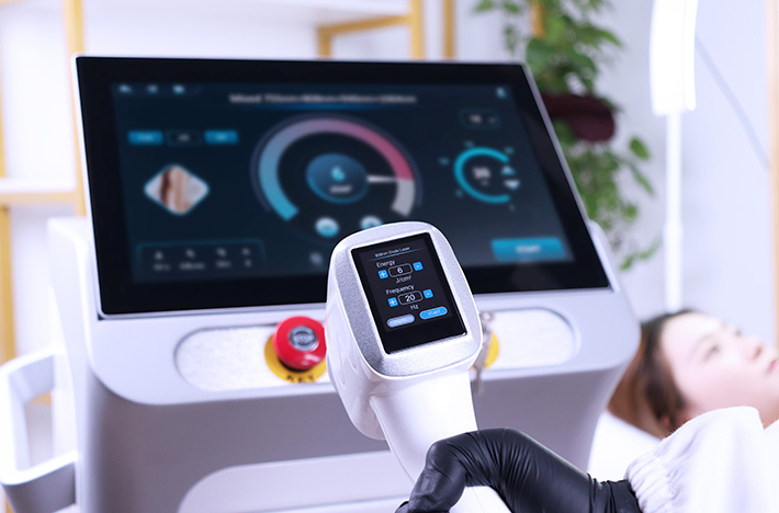 AresLite Diode Laser Machine