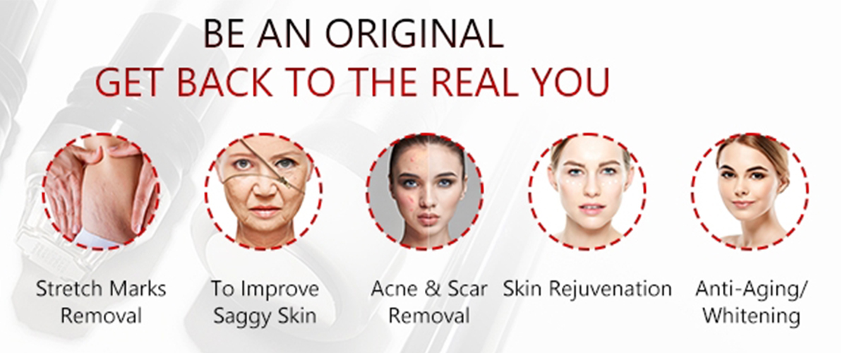 rf microneedle treat before and after