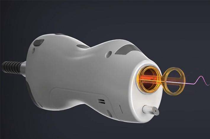 nd yag laser machine