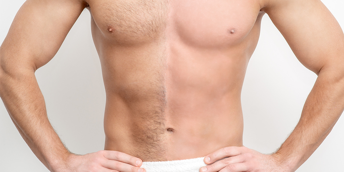 painless hair removal