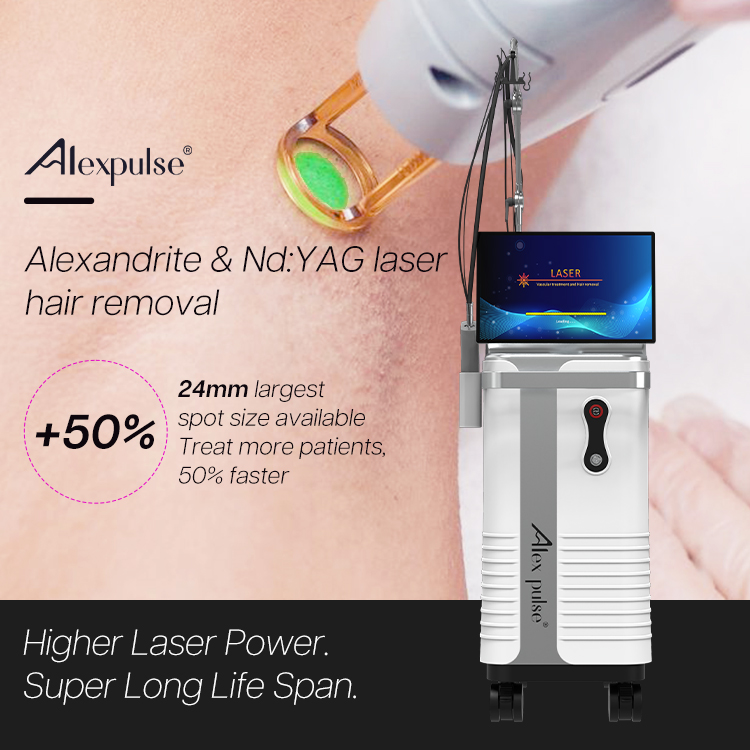 alexandrite laser hair removal