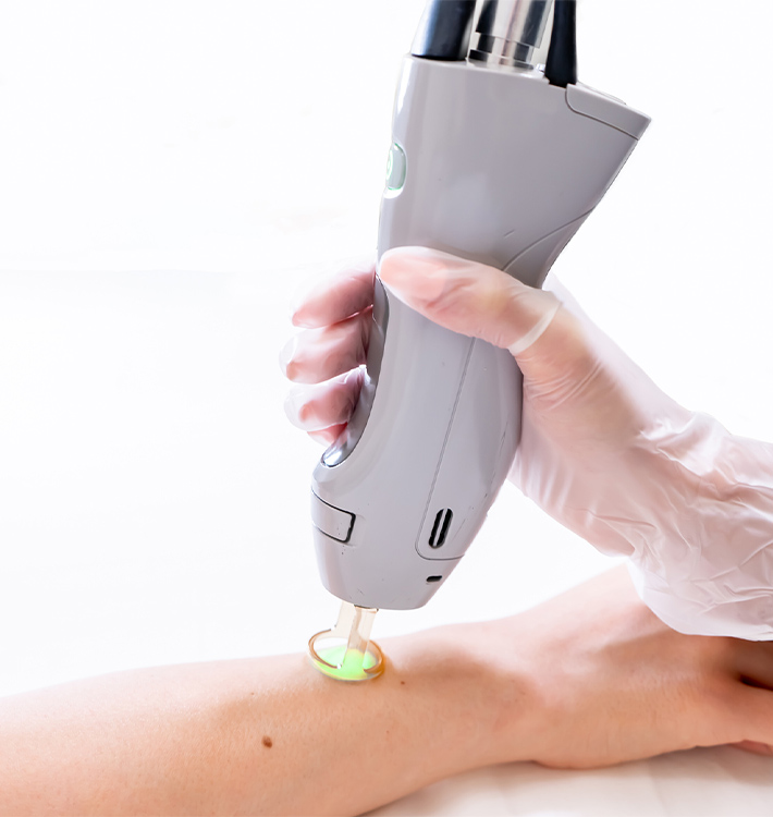 Professional Alexandrite Laser Hair Removal Machine CL300